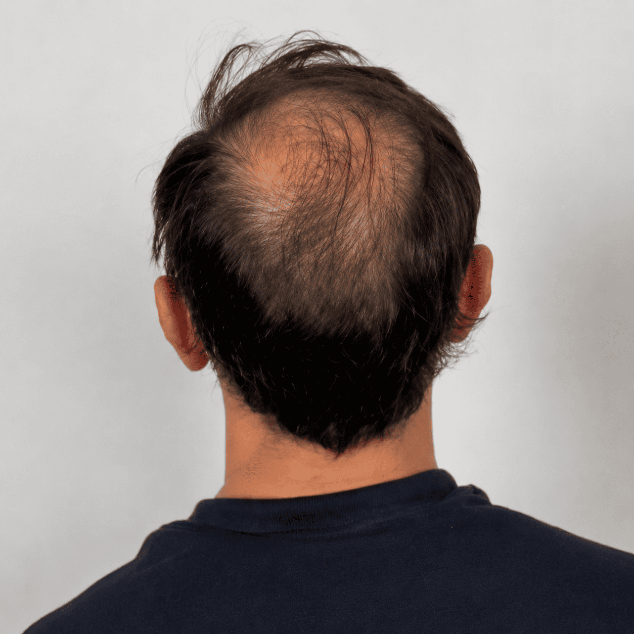 Rambut sebelum perawatan